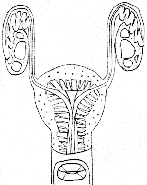 sketch of uterus (11491 bytes)